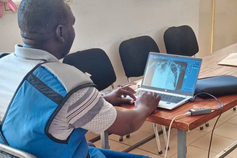 CAD4TB in Burkina Faso