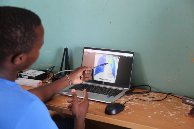 A radiographer is pointing at CAD4TB platform