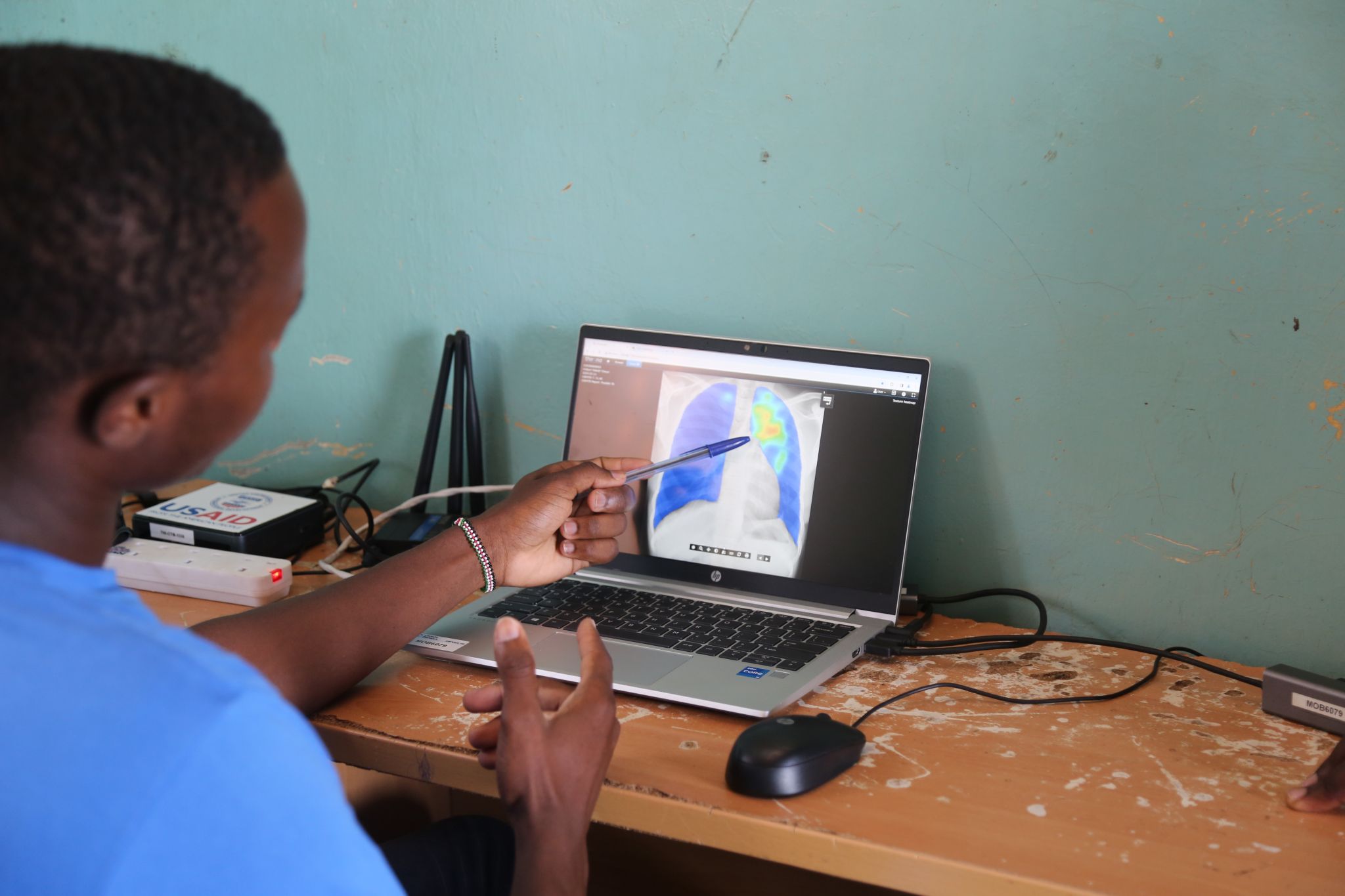 A radiographer is pointing at CAD4TB platform