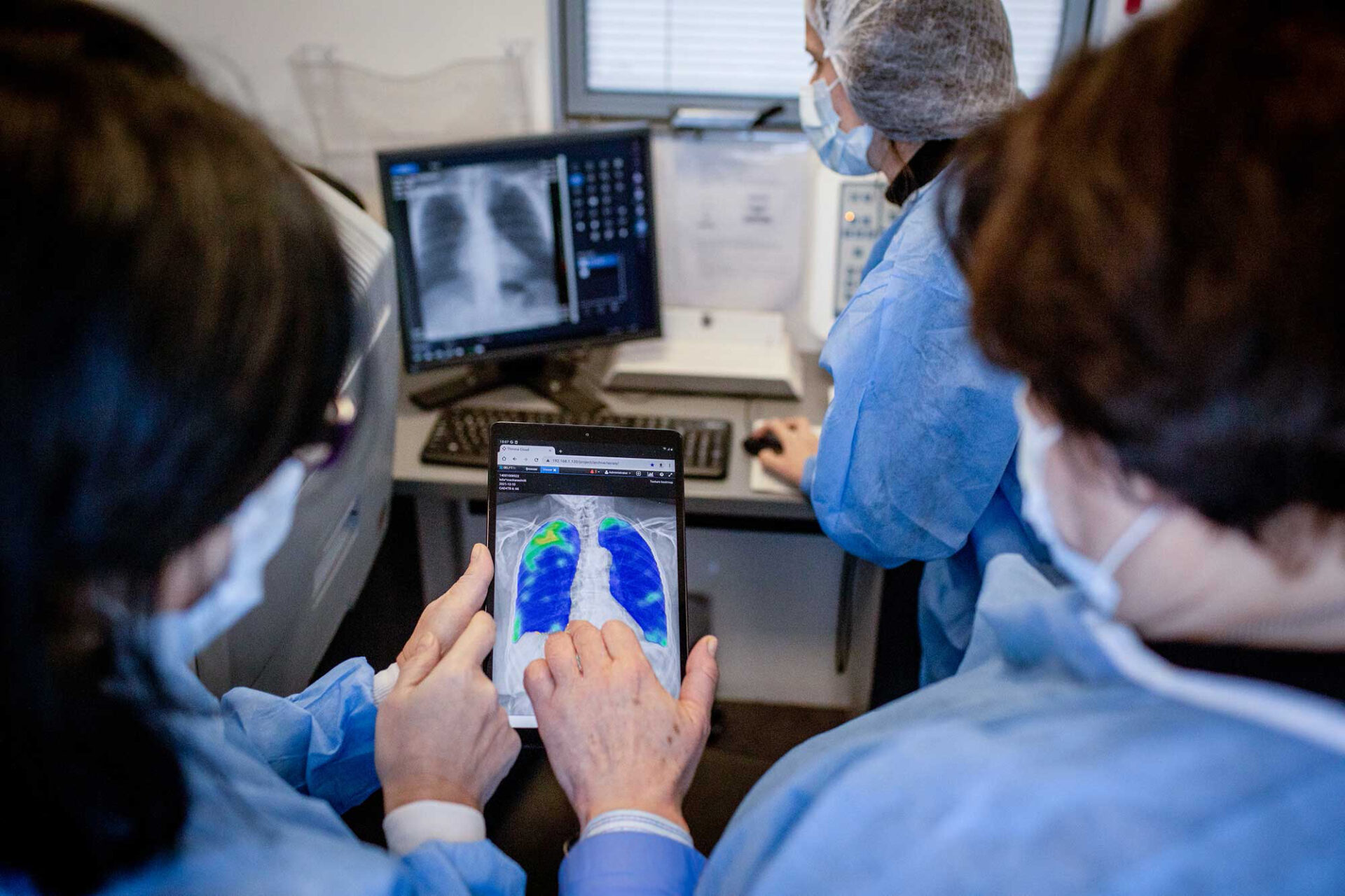 CAD4TB platform closeup