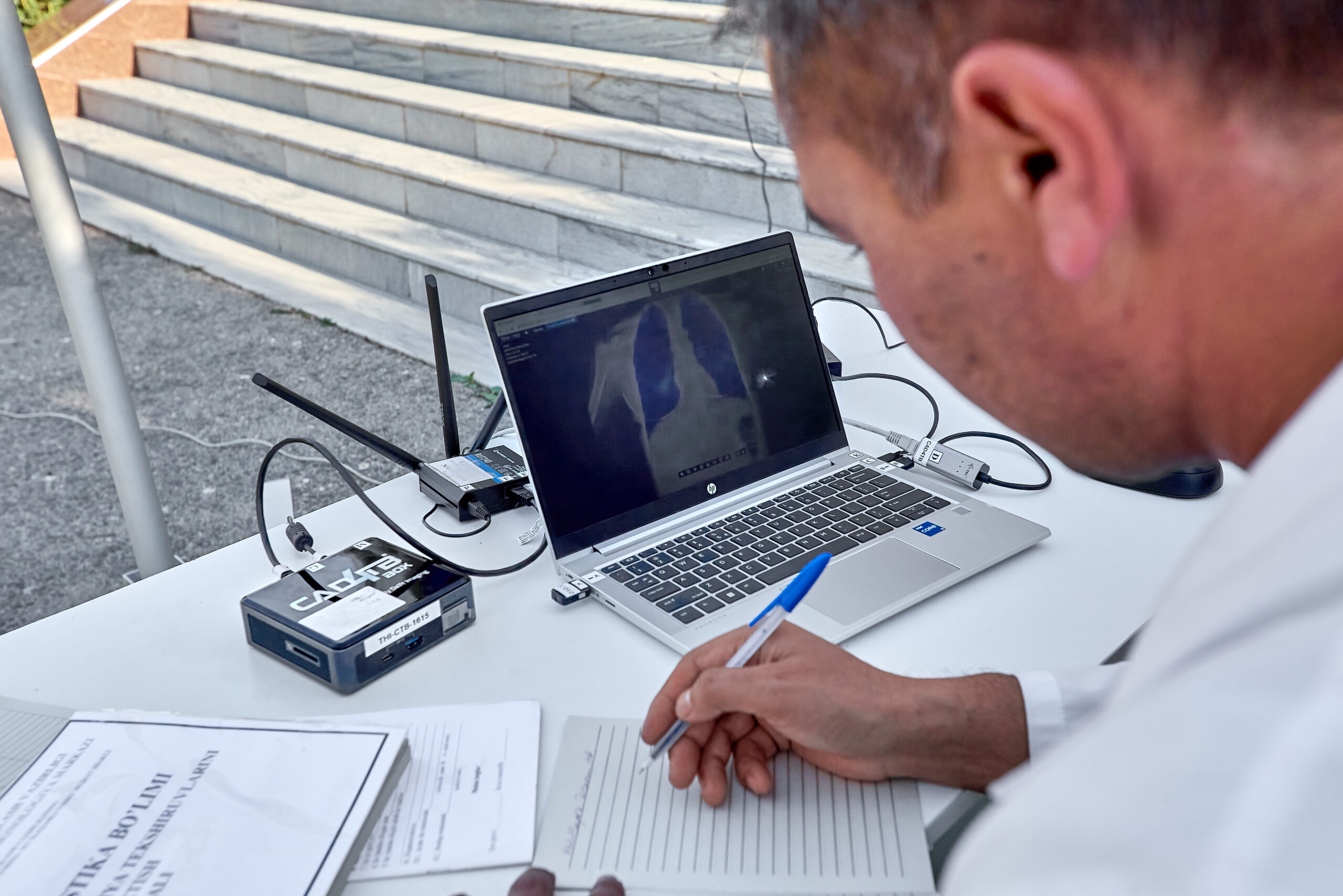 The radiographer in Uzbekistan is looking into CAD4TB platform