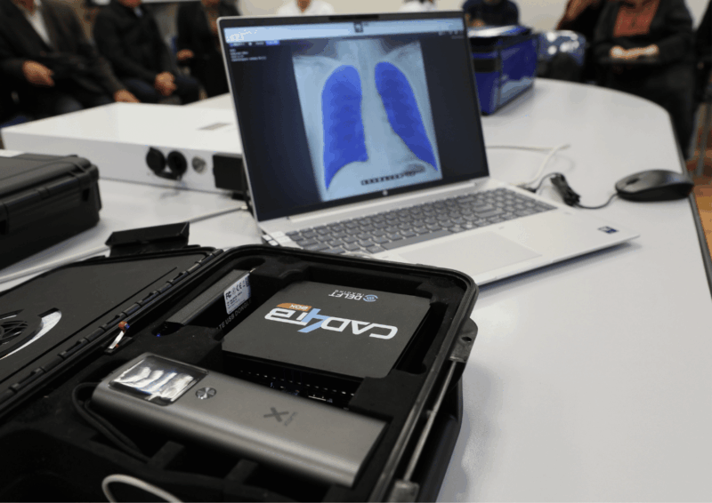 CAD4TB training in Turkmenistan