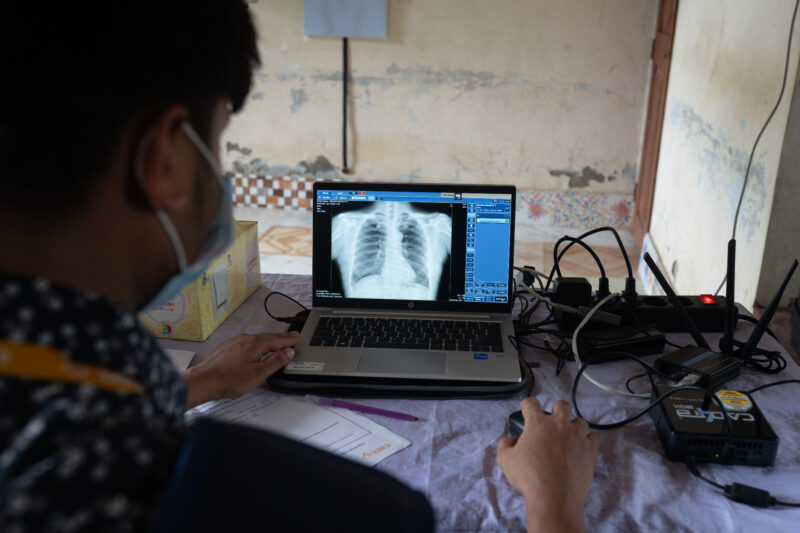 CAD4TB in Bangladesh