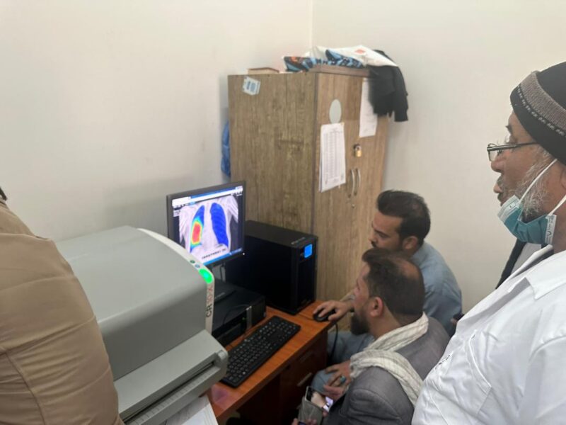 CAD4TB in Afghanistan