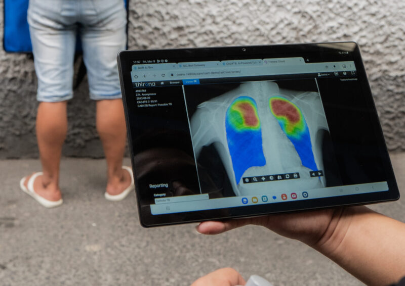 CAD4TB in Philippines