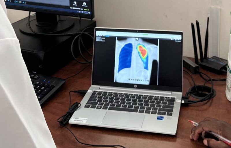 CAD4TB in Mozambique