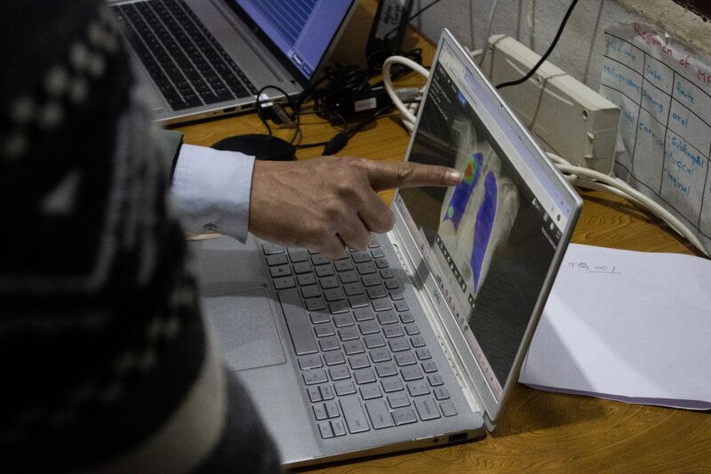 The radiographer is pointing at the CAD4TB screen