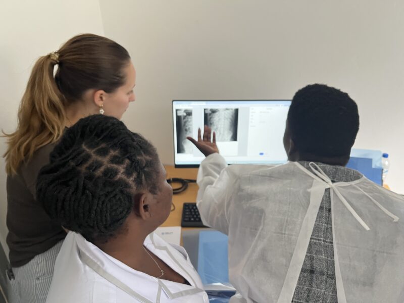 radiographers in Mozambique are looking at the CAD4TB screen
