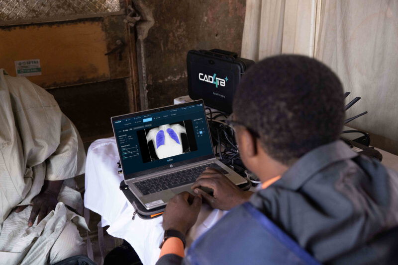 CAD4TB+ is being used in Nigeria