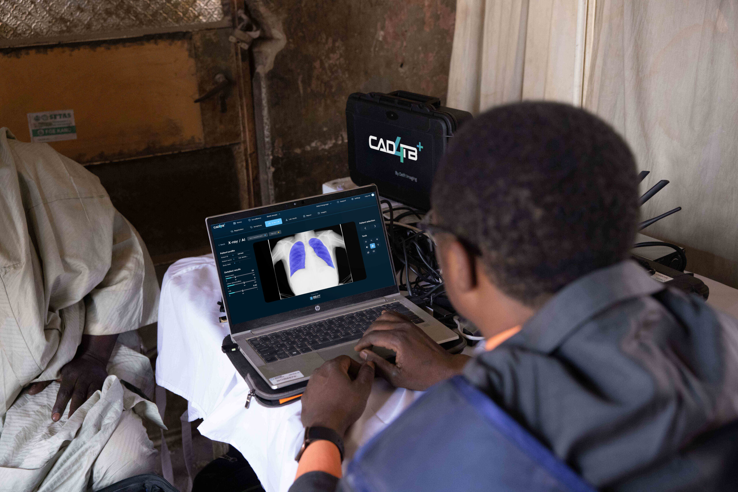 CAD4TB+ is being used in Nigeria