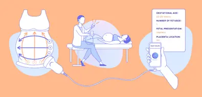 Figure 1: BabyChecker Sweep Protocol diagram showing the 6-sweep pattern