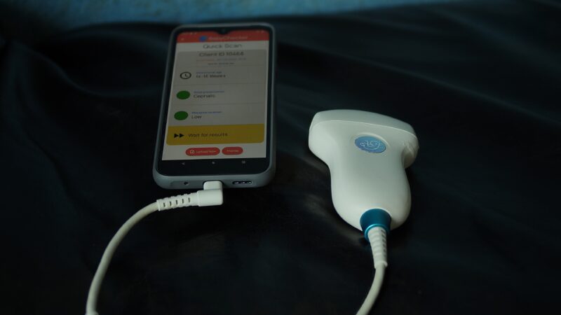 BabyChecker AI with the probe