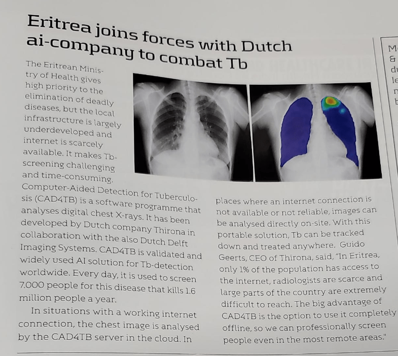 CAD4TB in Healthcare Radius edition