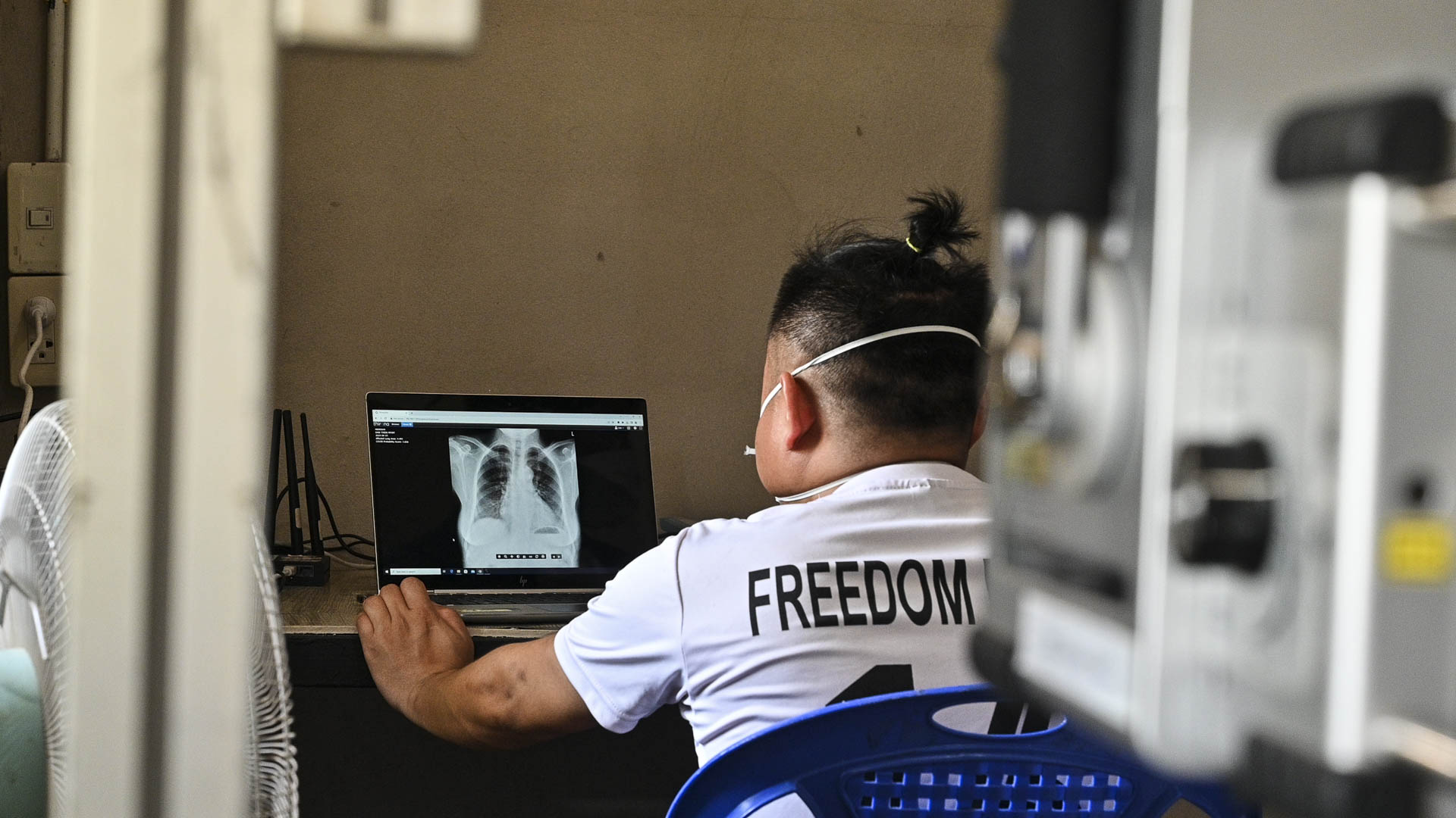 CAD4TB in SMRU Thailand