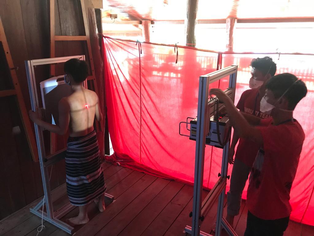 TB screening with Delft Light in SMRU Thailand